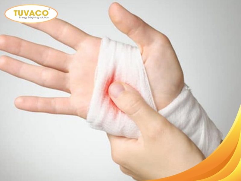 Gây trầy xước hoặc đứt tay chân